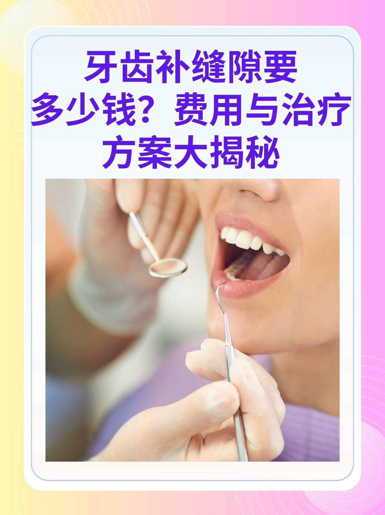 永州补牙医保可以报销吗(补牙医保可以报销吗 哪些可以报销呢)